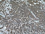 ARF1 Antibody in Immunohistochemistry (Paraffin) (IHC (P))