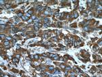 ARF1 Antibody in Immunohistochemistry (Paraffin) (IHC (P))