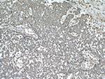 ARF1 Antibody in Immunohistochemistry (Paraffin) (IHC (P))