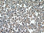 ARF1 Antibody in Immunohistochemistry (Paraffin) (IHC (P))