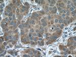 ARF1 Antibody in Immunohistochemistry (Paraffin) (IHC (P))