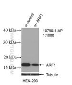 ARF1 Antibody in Western Blot (WB)