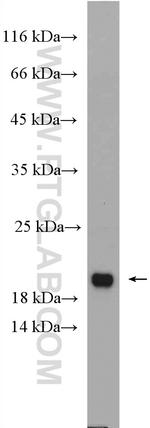 ARF1 Antibody in Western Blot (WB)