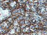 Alpha adducin Antibody in Immunohistochemistry (Paraffin) (IHC (P))