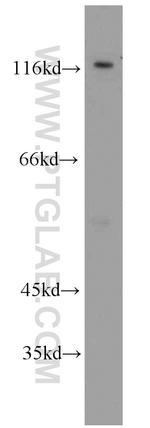 Alpha adducin Antibody in Western Blot (WB)