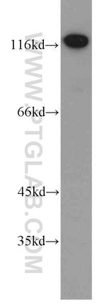 Alpha adducin Antibody in Western Blot (WB)