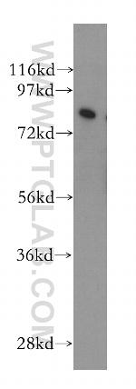 REC8 Antibody in Western Blot (WB)