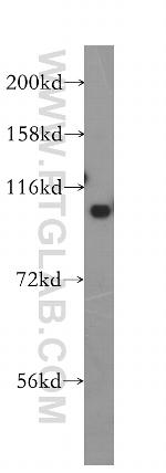 MTHFD1 Antibody in Western Blot (WB)