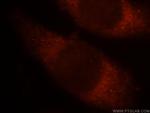 Sestrin 2 Antibody in Immunocytochemistry (ICC/IF)