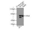 Sestrin 2 Antibody in Immunoprecipitation (IP)