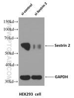 Sestrin 2 Antibody in Western Blot (WB)