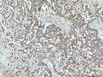 Sestrin 2 Antibody in Immunohistochemistry (Paraffin) (IHC (P))