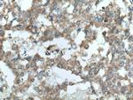 Sestrin 2 Antibody in Immunohistochemistry (Paraffin) (IHC (P))