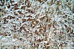 Sestrin 2 Antibody in Immunohistochemistry (Paraffin) (IHC (P))