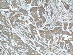 Sestrin 2 Antibody in Immunohistochemistry (Paraffin) (IHC (P))