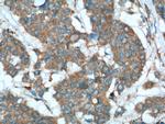 Sestrin 2 Antibody in Immunohistochemistry (Paraffin) (IHC (P))