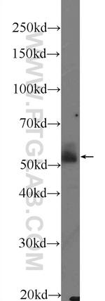 Sestrin 2 Antibody in Western Blot (WB)