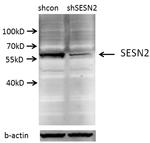 Sestrin 2 Antibody in Western Blot (WB)