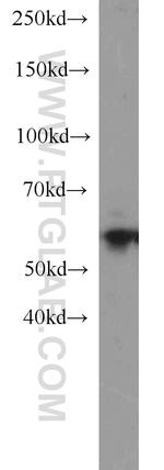 Sestrin 2 Antibody in Western Blot (WB)