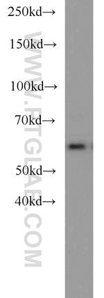 Sestrin 2 Antibody in Western Blot (WB)