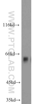 Sestrin 2 Antibody in Western Blot (WB)