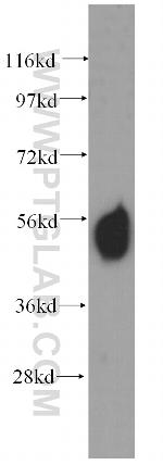 Sestrin 2 Antibody in Western Blot (WB)