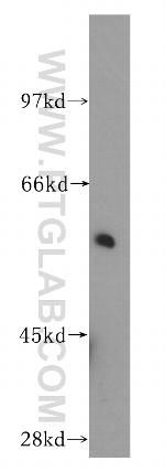 Sestrin 2 Antibody in Western Blot (WB)