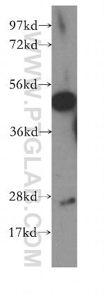 CNTFR Antibody in Western Blot (WB)