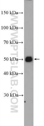 CNTFR Antibody in Western Blot (WB)