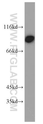 TRIP10 Antibody in Western Blot (WB)