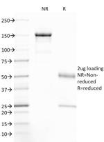 CFTR (Cystic Fibrosis Transmembrane Conductance Regulator) Antibody in SDS-PAGE (SDS-PAGE)