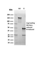 CFTR (Cystic Fibrosis Transmembrane Conductance Regulator) Antibody in SDS-PAGE (SDS-PAGE)