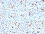 CFTR (Cystic Fibrosis Transmembrane Conductance Regulator) Antibody in Immunohistochemistry (Paraffin) (IHC (P))