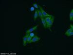 ARF3 Antibody in Immunocytochemistry (ICC/IF)