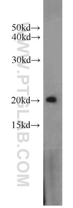 ARF3 Antibody in Western Blot (WB)