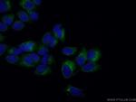 PSAP Antibody in Immunocytochemistry (ICC/IF)