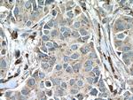 PSAP Antibody in Immunohistochemistry (Paraffin) (IHC (P))