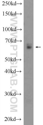 PSAP Antibody in Western Blot (WB)