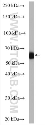 PSAP Antibody in Western Blot (WB)