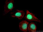 Geminin Antibody in Immunocytochemistry (ICC/IF)