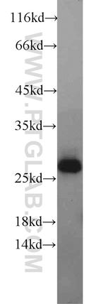 Geminin Antibody in Western Blot (WB)