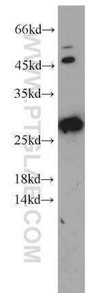 Geminin Antibody in Western Blot (WB)