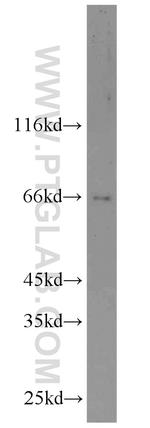 DDX5/p68 Antibody in Western Blot (WB)