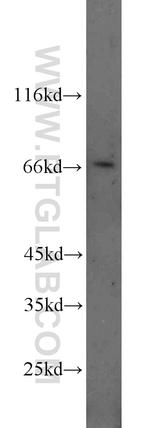 DDX5/p68 Antibody in Western Blot (WB)