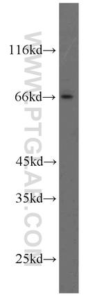 DDX5/p68 Antibody in Western Blot (WB)