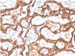 HCG-beta Antibody in Immunohistochemistry (Paraffin) (IHC (P))