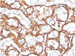 HCG-beta Antibody in Immunohistochemistry (Paraffin) (IHC (P))