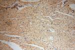 HERP Antibody in Immunohistochemistry (Paraffin) (IHC (P))