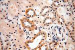 HERP Antibody in Immunohistochemistry (Paraffin) (IHC (P))