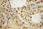 HERP Antibody in Immunohistochemistry (Paraffin) (IHC (P))